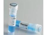 链球菌溶血素O抗原，Streptolysin O protein