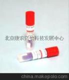 酪丁酸梭菌 ATCC 25755 中国总代理-18701046867-北京康农兴牧
