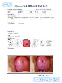 南京市供应瓷白A4医用胶片