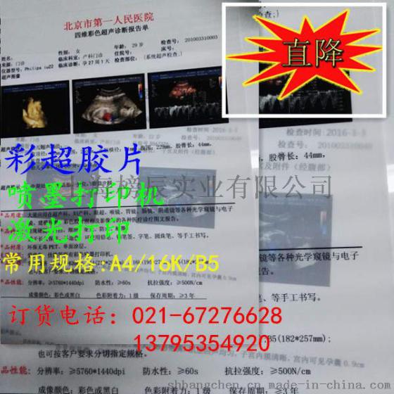 供应医用白瓷片打印纸医用胶片彩色喷墨pet胶片纸
