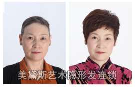 上海假发哪里好女士假发美黛斯口碑好